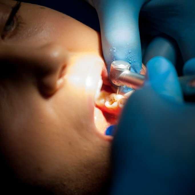 Servicii stomatologice de odontoterapie