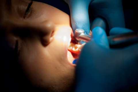 Servicii stomatologice de odontoterapie