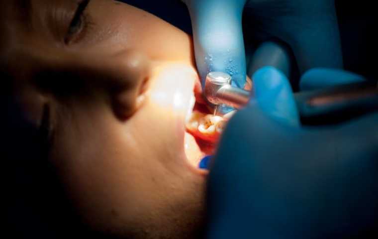 Servicii stomatologice de odontoterapie