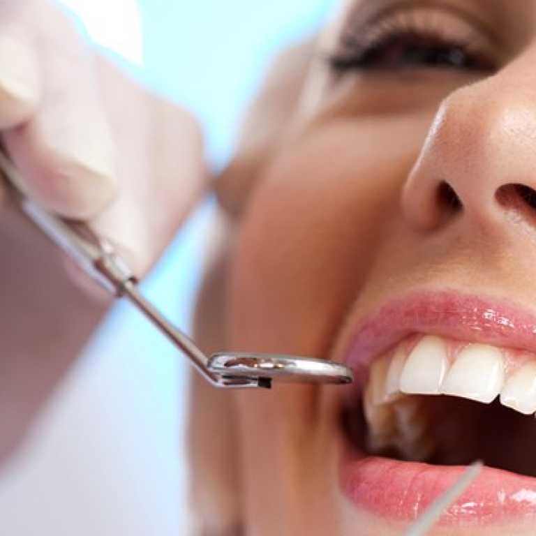 Servicii stomatologice de parodontologie