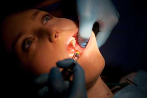 Servicii de chirurgie dentară