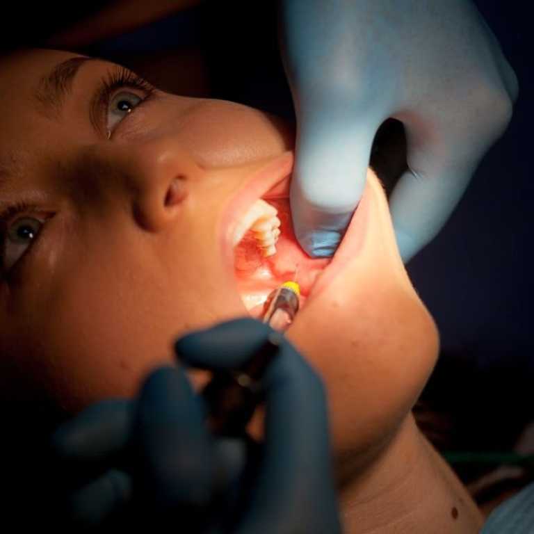 Servicii de chirurgie dentară