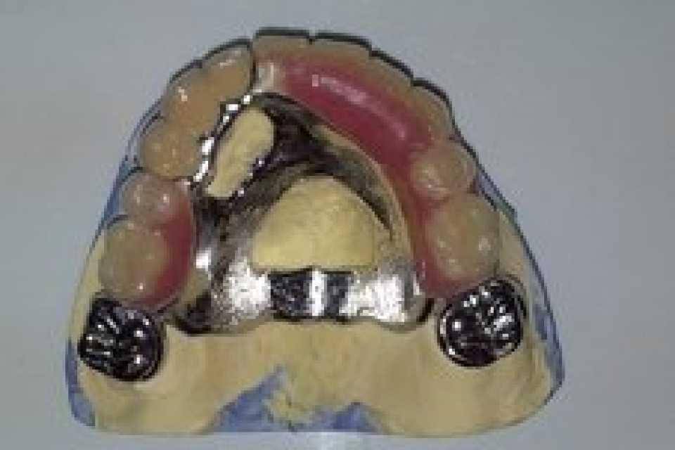 Foto 1-2