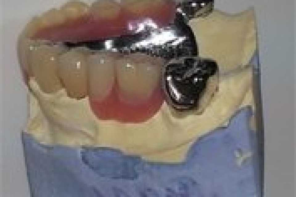 Foto 1-4