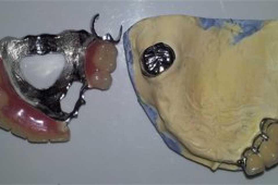 Foto 1-5