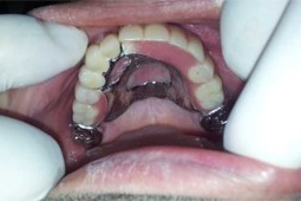 Foto 1-8