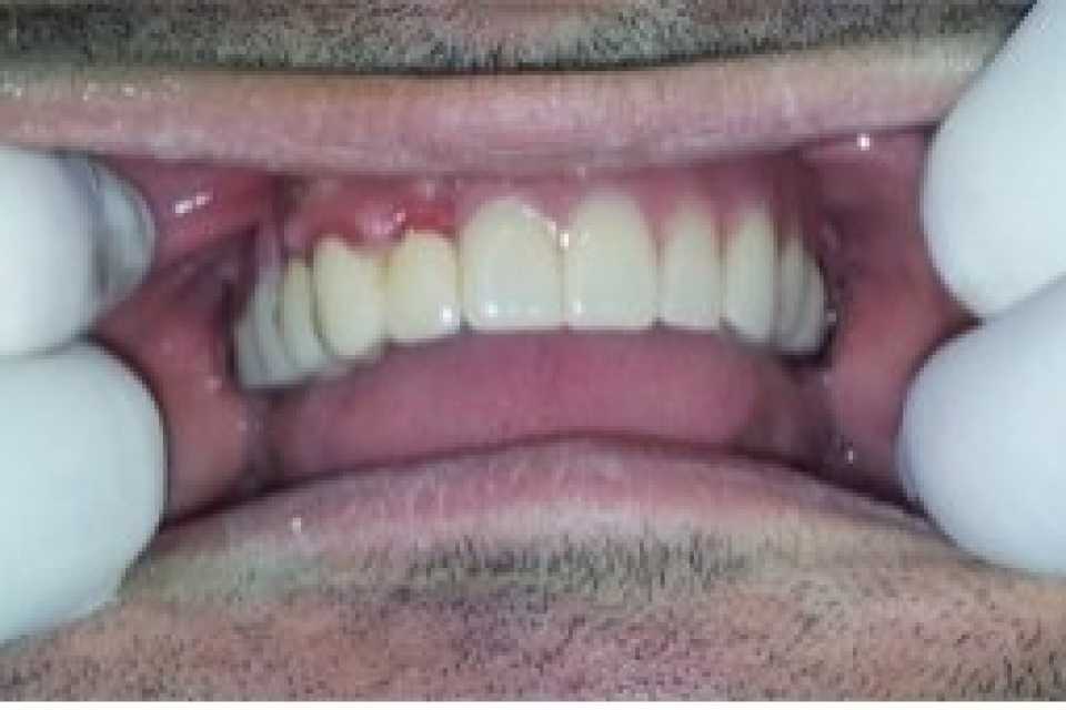 Foto 1-9