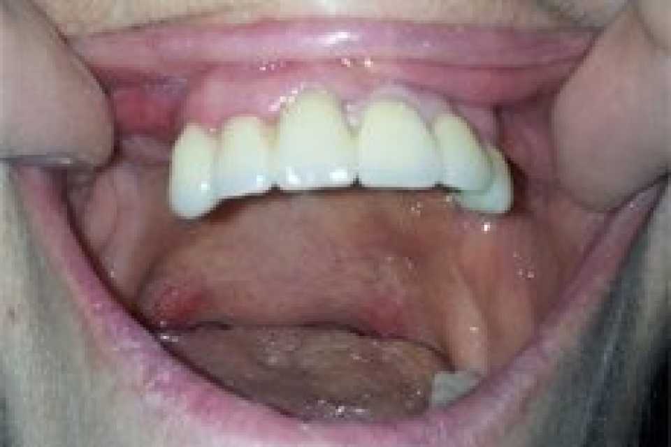 Foto 2-1