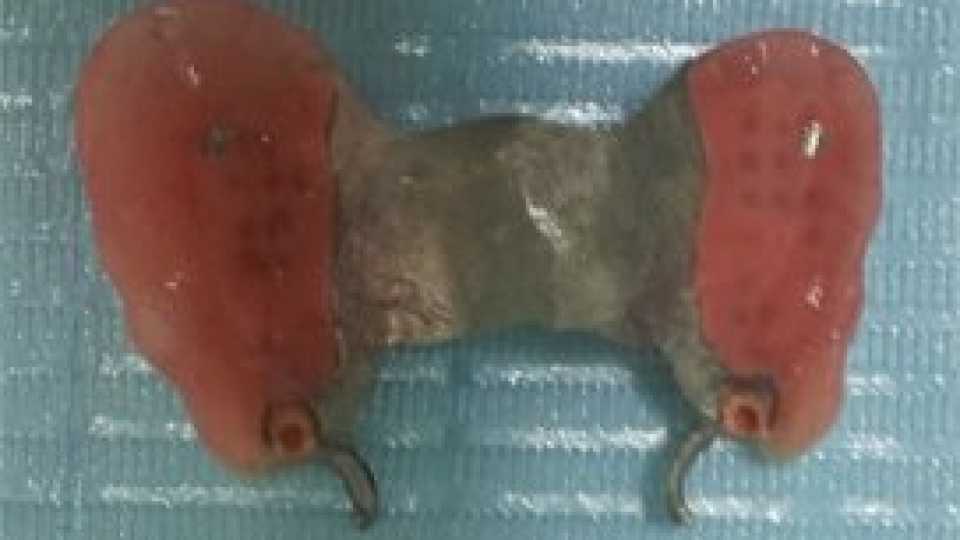 Foto 2-2