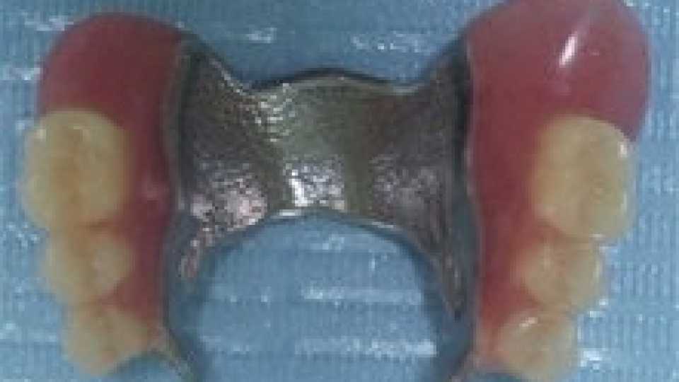 Foto 2-3