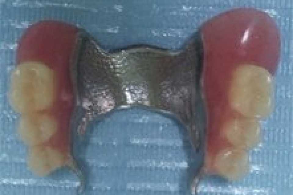 Foto 2-3