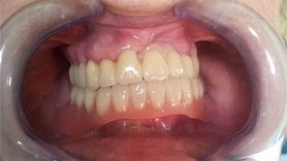 Foto 2-6