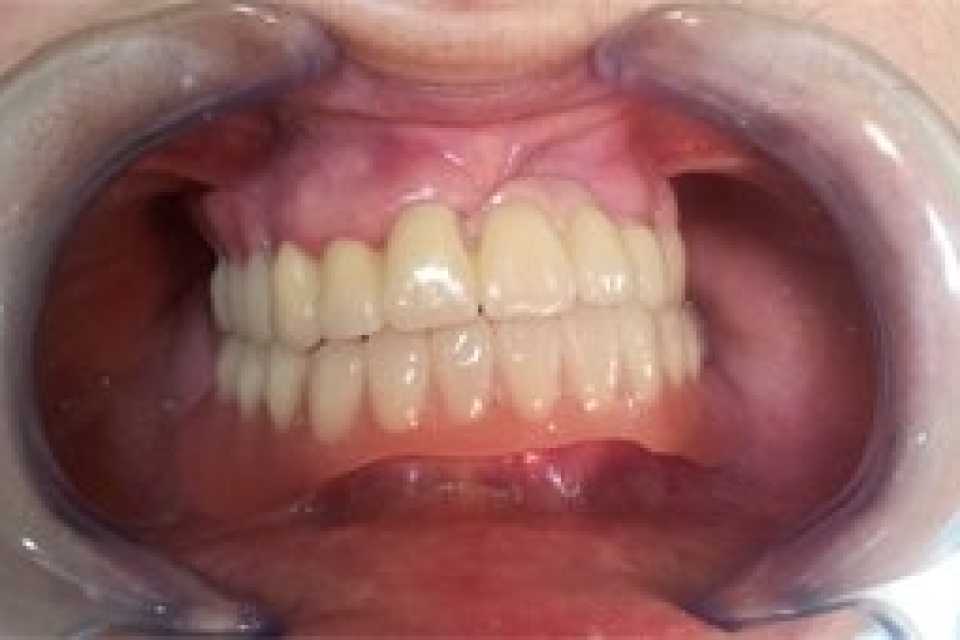 Foto 2-6