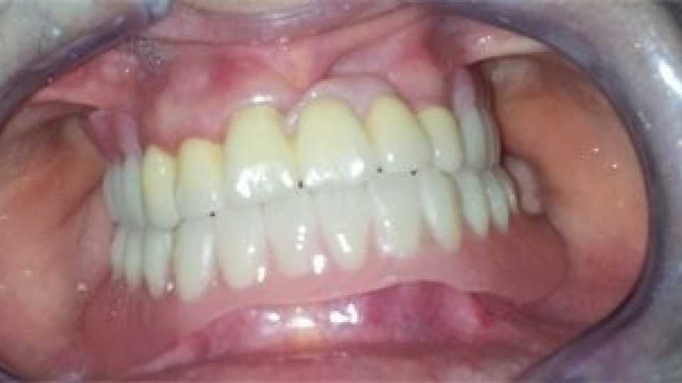 Foto 2-7