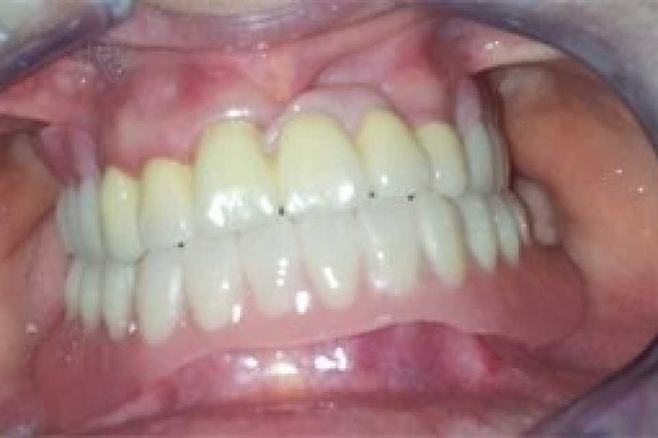 Foto 2-7
