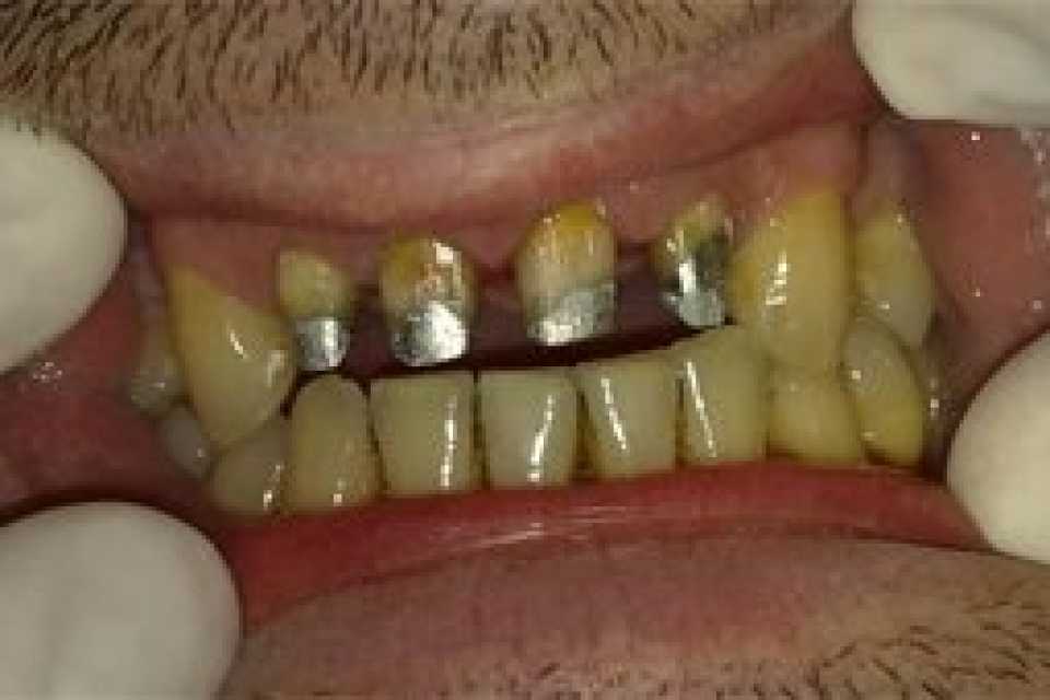 Foto 5-1