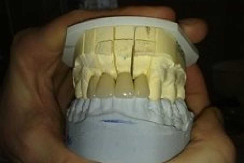 Foto 5-2