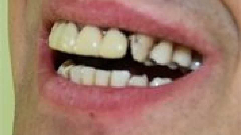 Foto 6-2