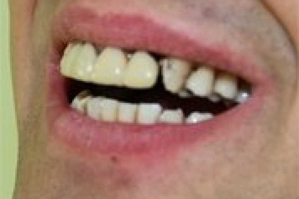 Foto 6-2