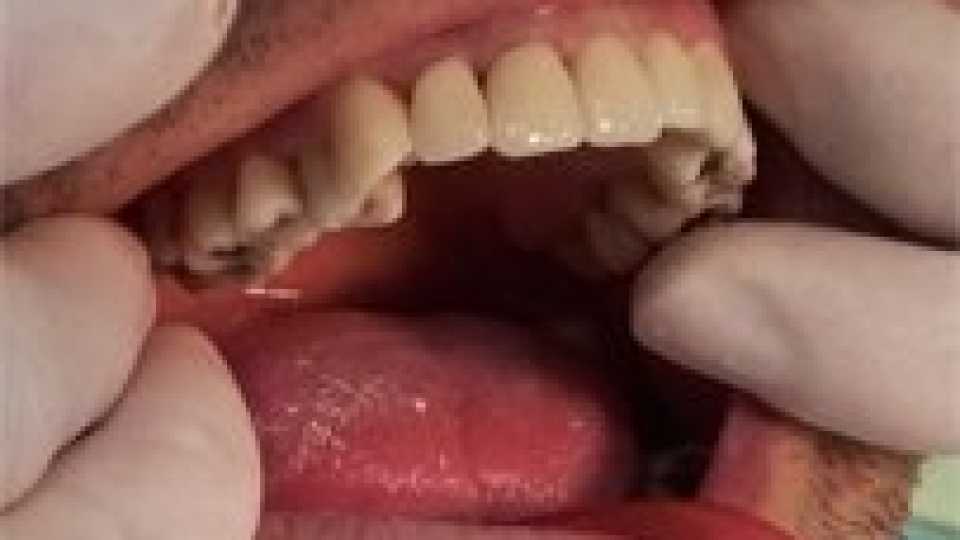 Foto 6-3