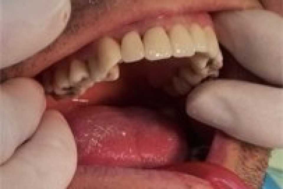 Foto 6-3