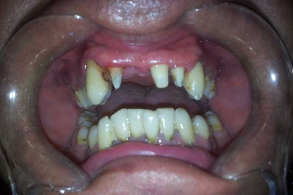 Foto 7-1