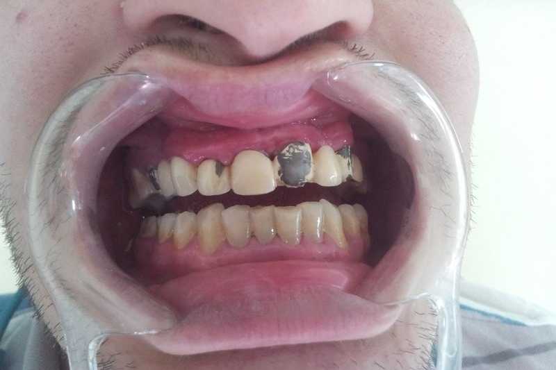Foto 8-1
