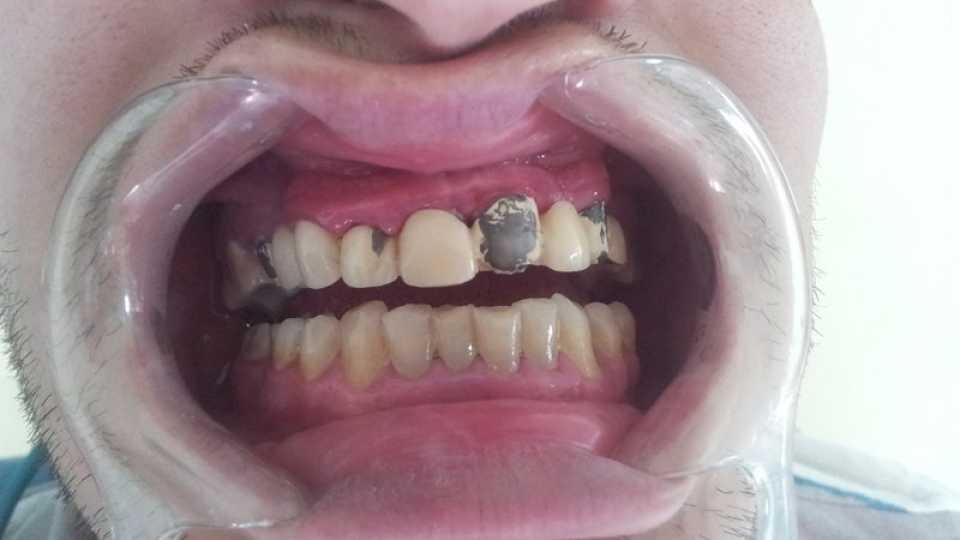 Foto 8-1