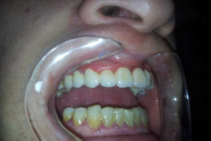 Foto 8-2