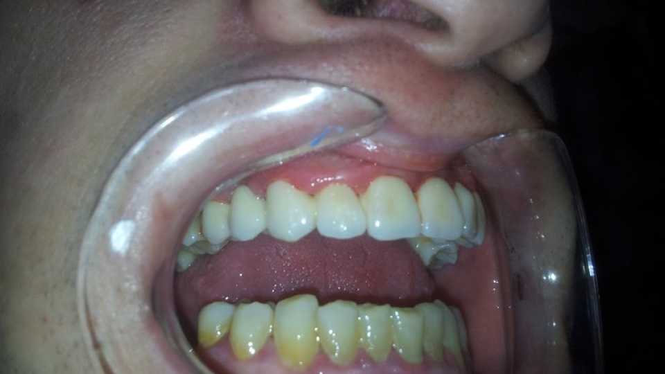 Foto 8-2