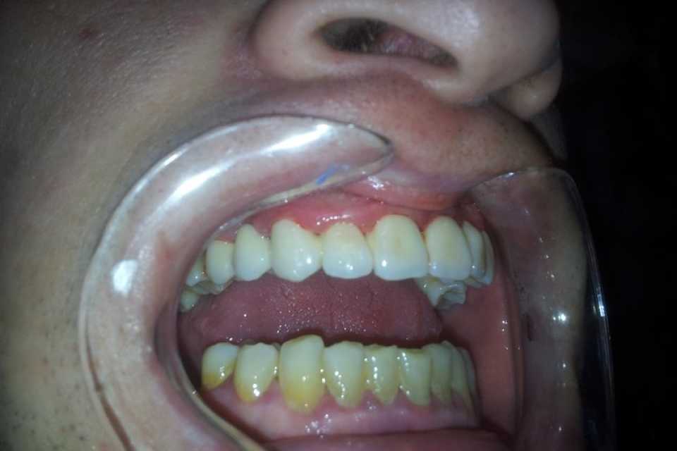 Foto 8-2