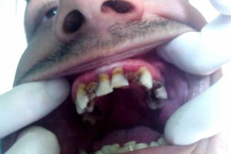 Foto 9-1