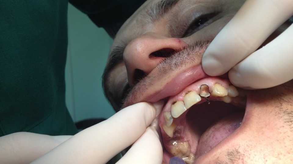 Foto 12-1