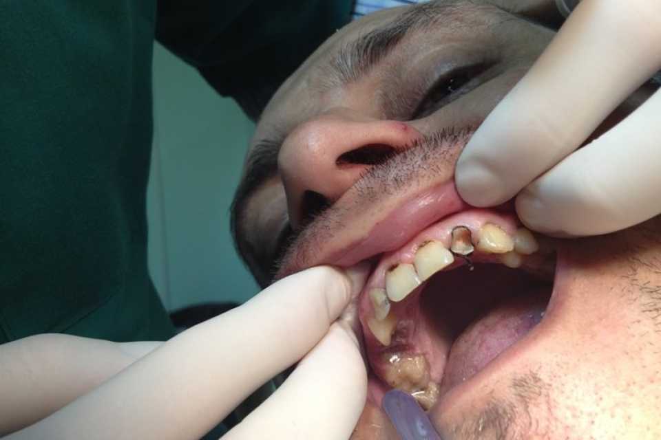 Foto 12-1