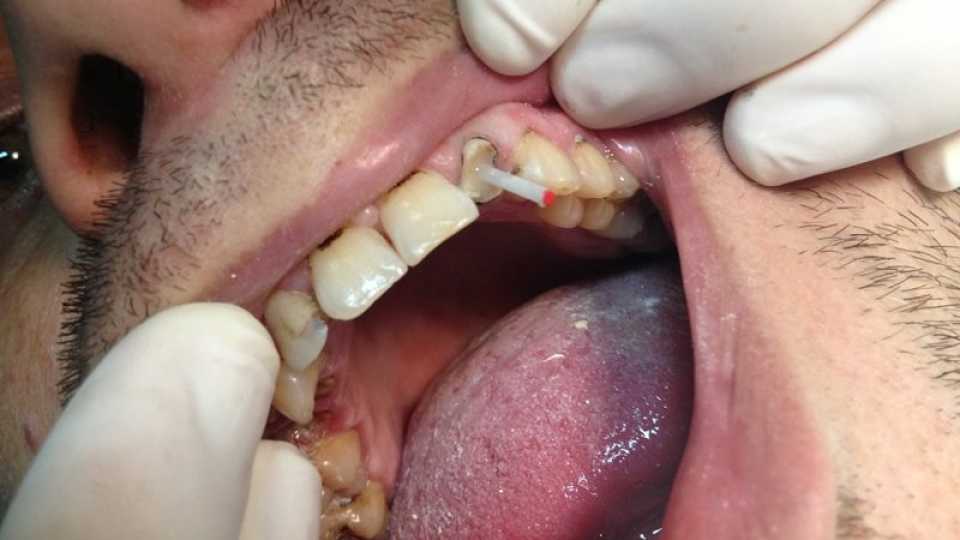Foto 12-2