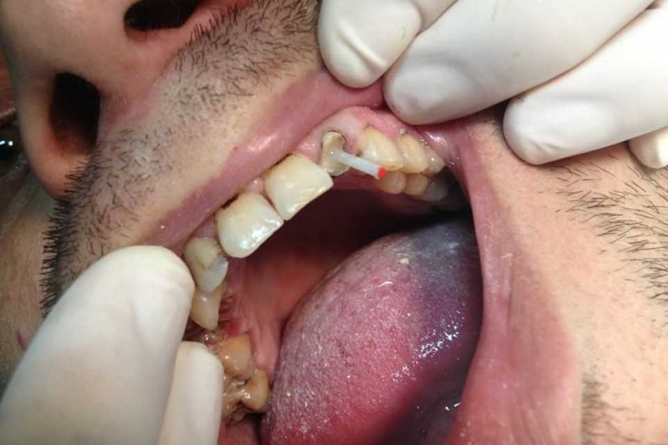 Foto 12-2