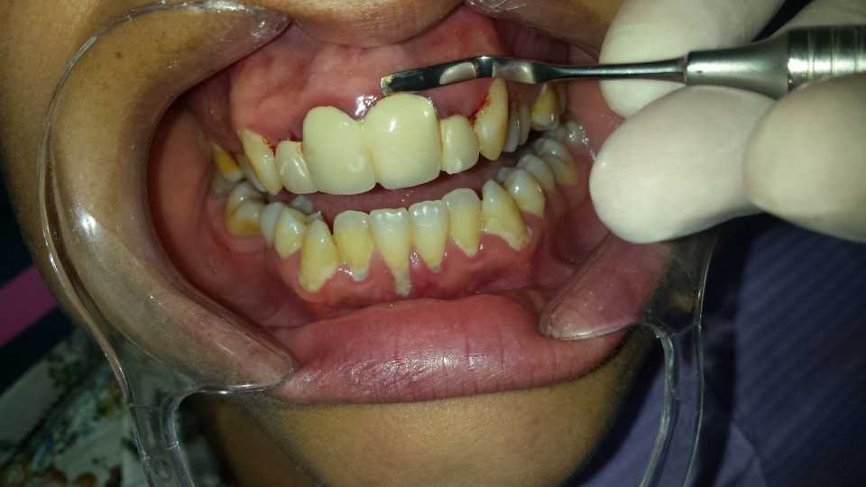 Foto 17-1