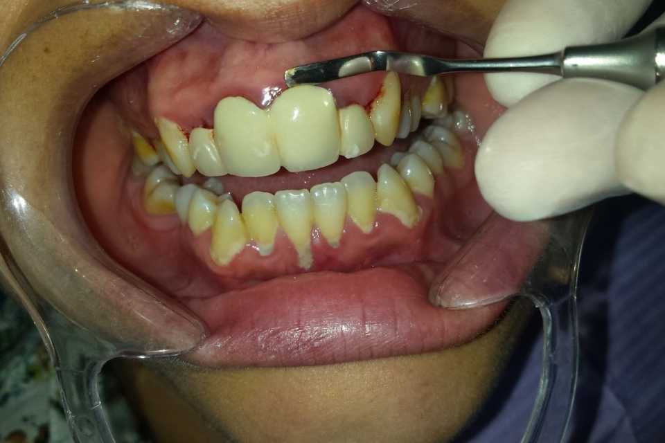 Foto 17-1