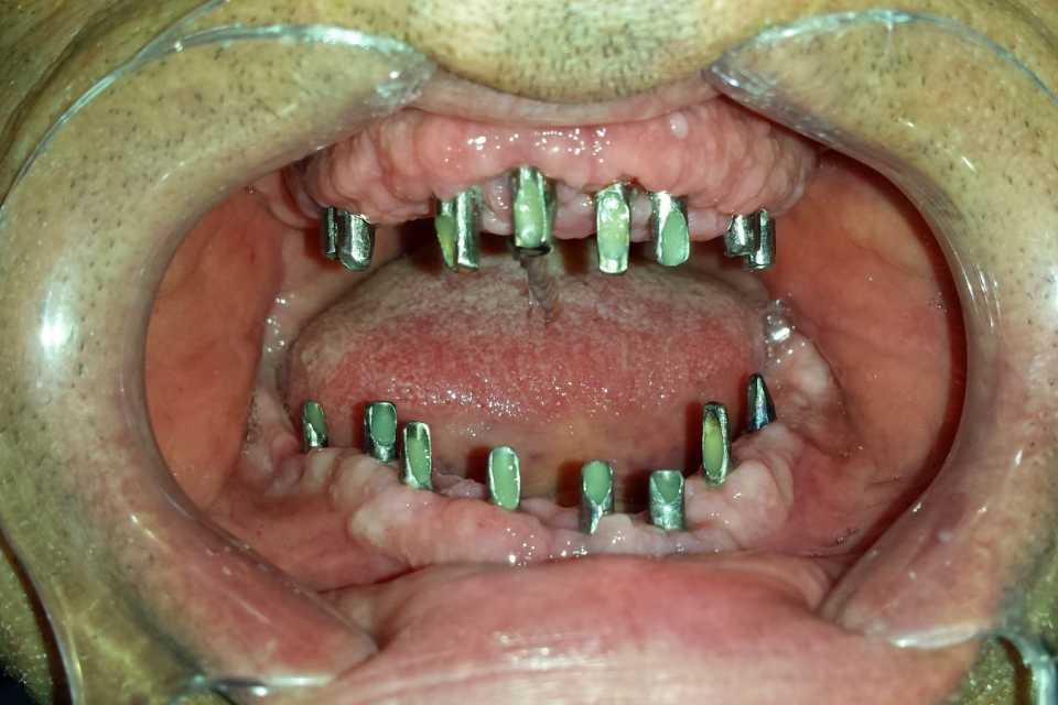 Foto 19-1