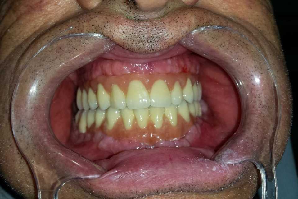 Foto 19-3
