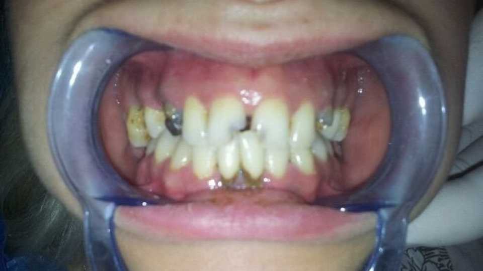 Foto 25-2