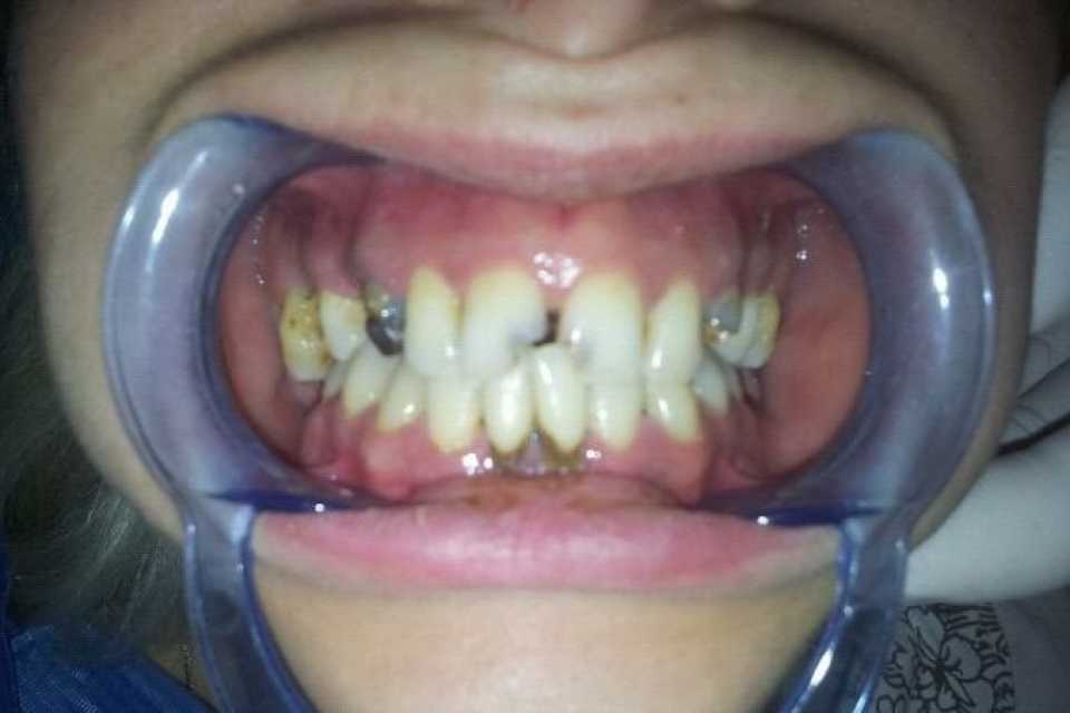 Foto 25-2