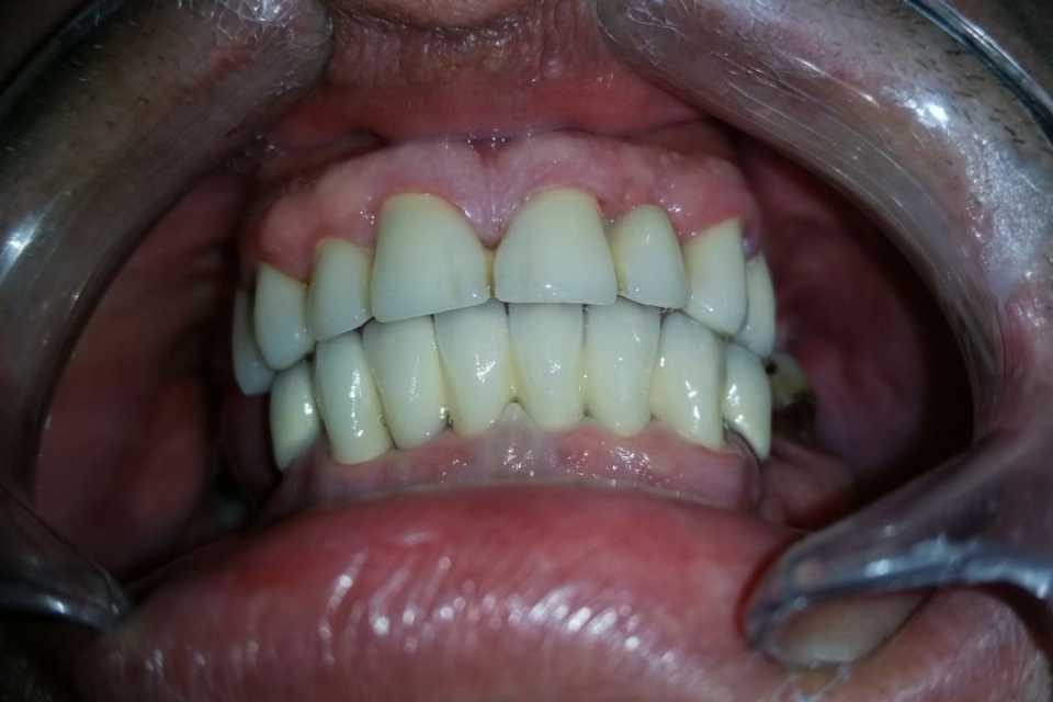 Foto 28-2