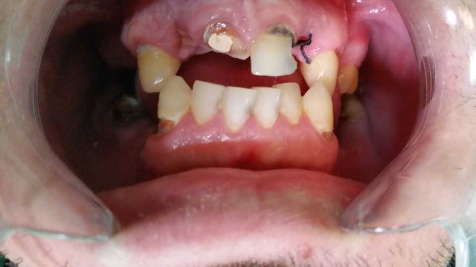 Foto 32-1