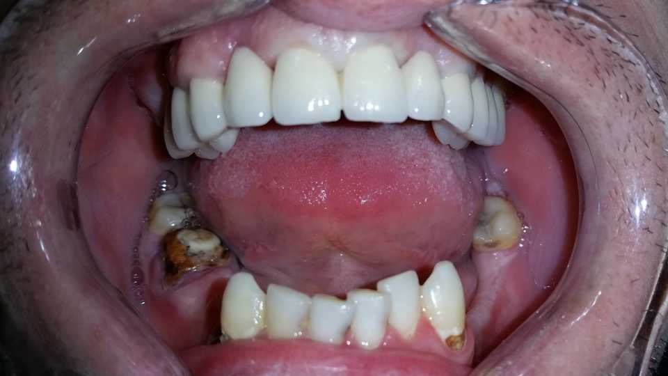Foto 32-3