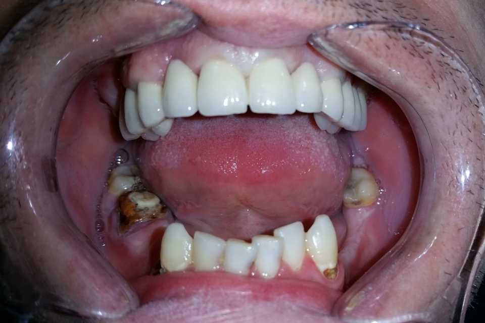 Foto 32-3