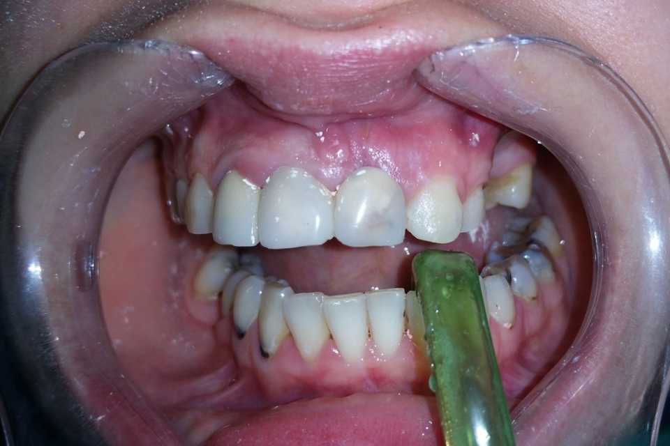 Foto 33-1