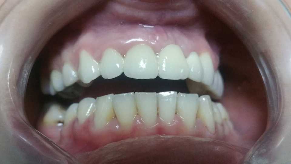 Foto 33-2