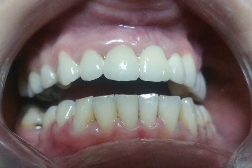 Foto 33-2