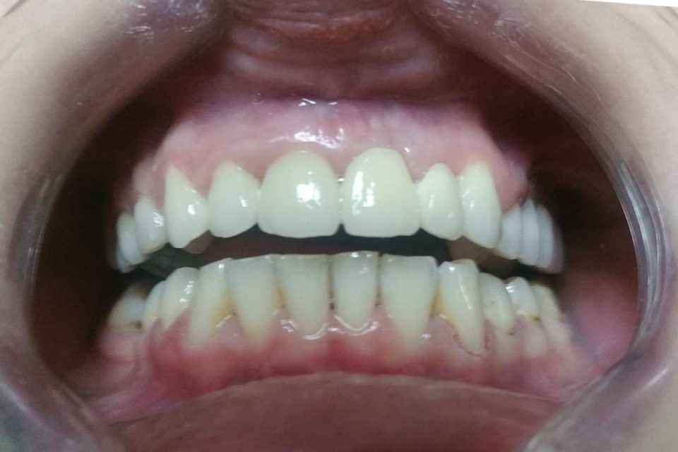 Foto 33-3